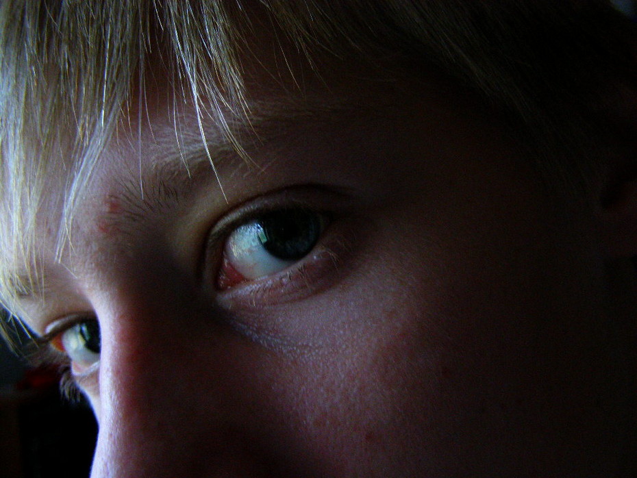 2008-05-11 12:28:36: глаз